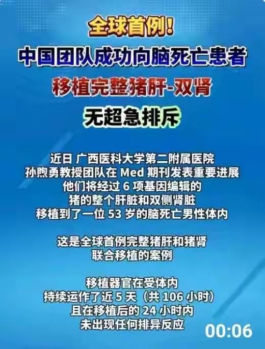猪脑移植到人不行吗？
解决脑死亡不行吗？