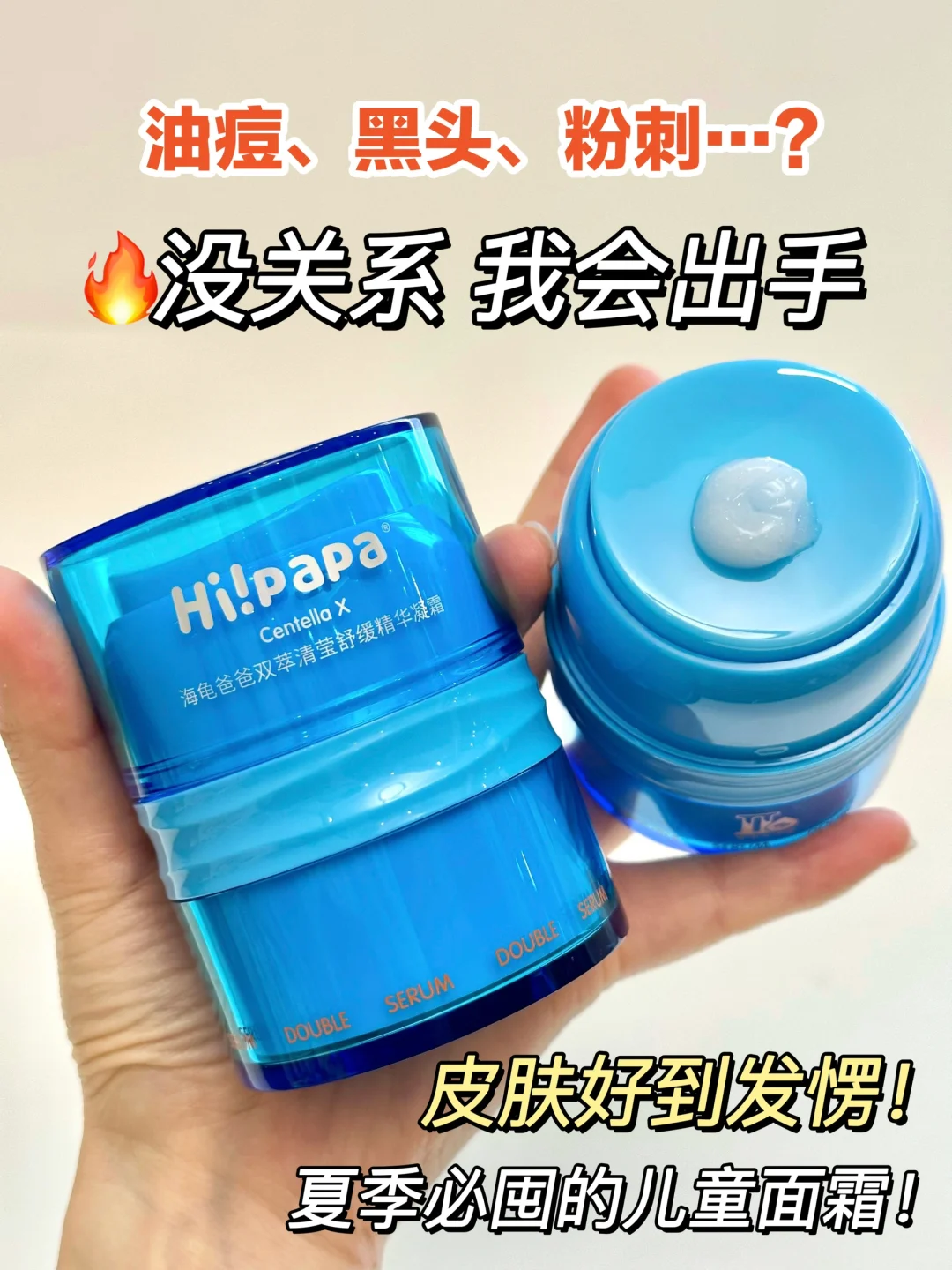 孩子皮肤冒油长痘❓儿童面霜你选对了吗！