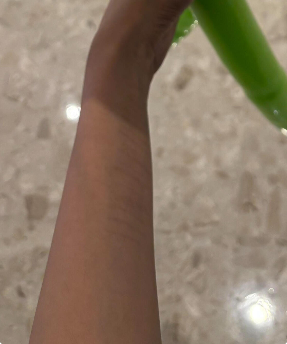 曝金子涵有抑郁症我觉得现在最大的问题是她的身体健康。之前还曝了她手腕都是伤痕，家