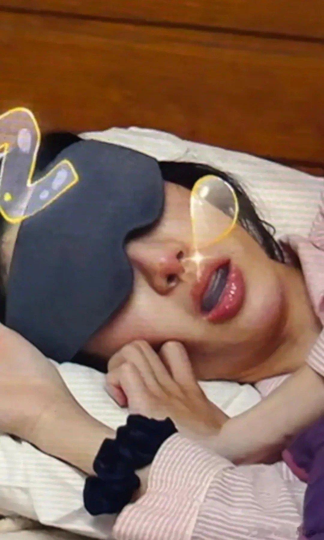 有人知道金晨鼻子里和嘴里都是啥嘛 ​​​