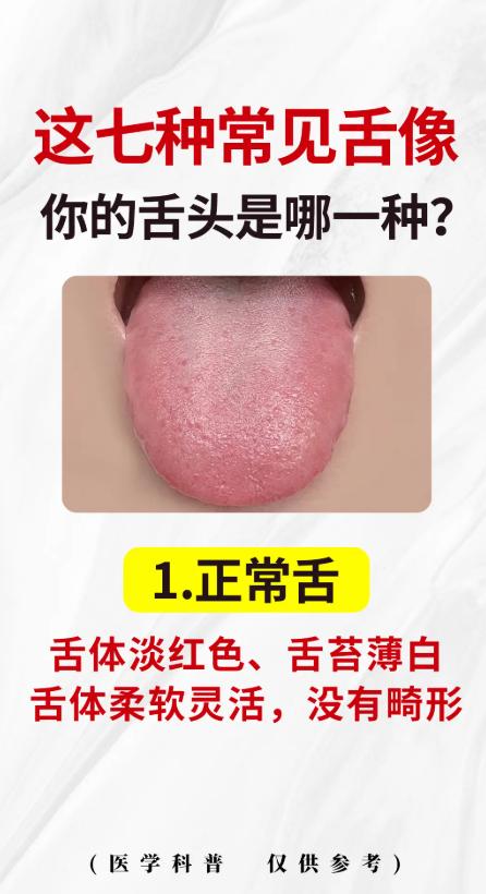 这几种常见舌象，对照看看你的舌头是哪一种？