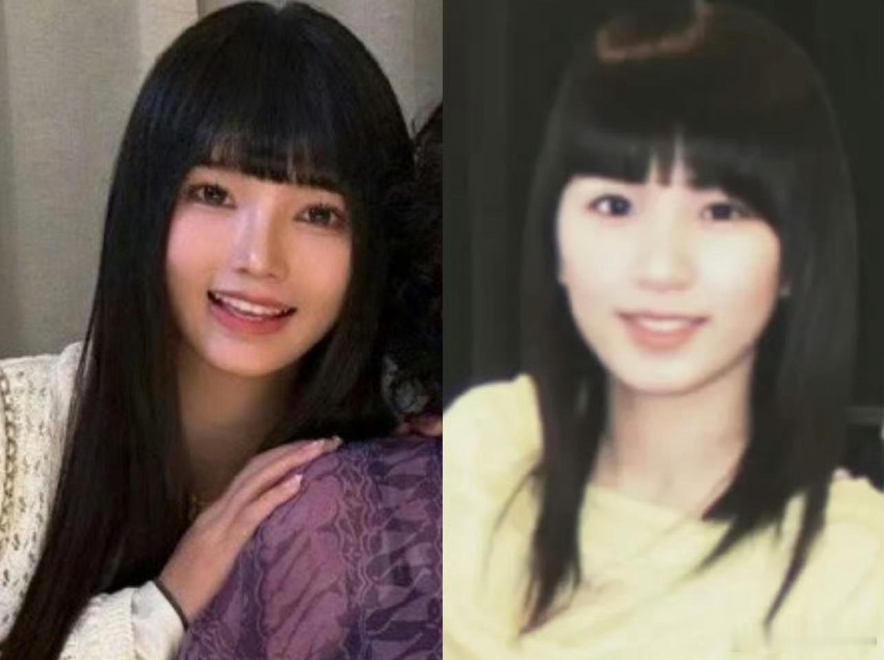 七七疑似怀孕，林俊杰这是跳过结婚直接当爸了？七七简直是翻版田馥甄 