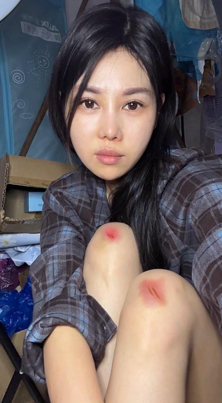 亲爱的朋友们，好久没露脸了。今天终于鼓足勇气写下这段话。消失的这段日子...