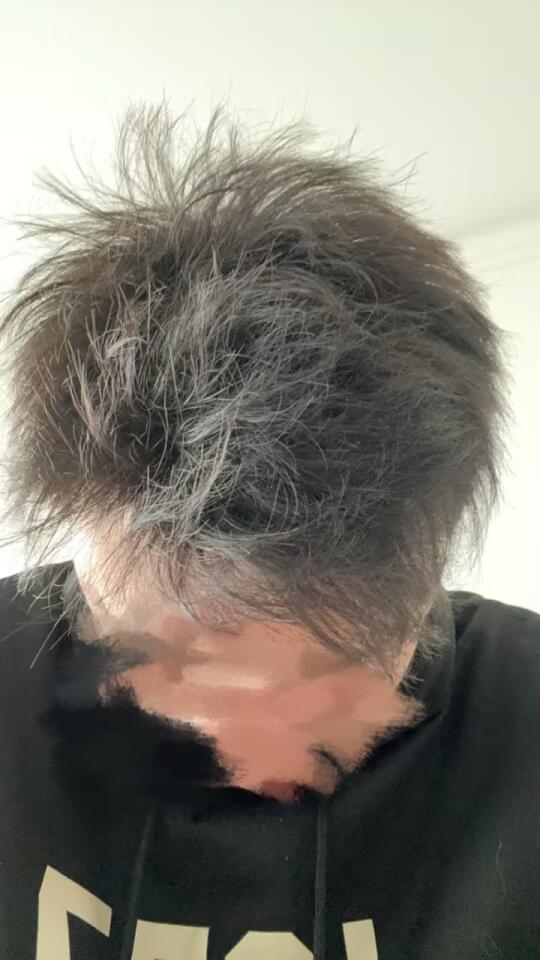 米诺919天 非那92天