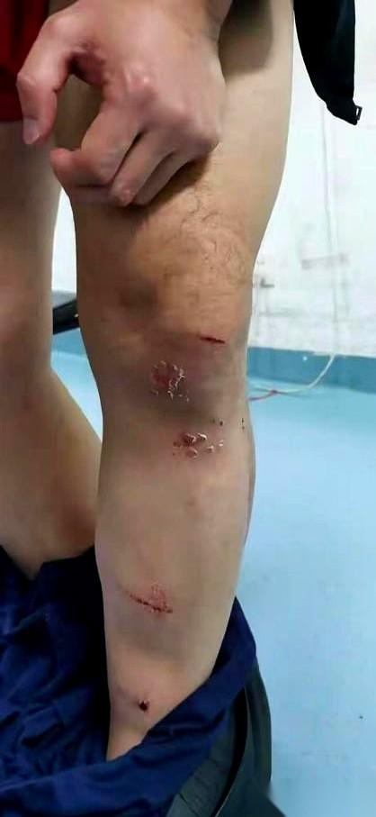 在武汉这个社区办公室里，就在众目睽睽之下，一个男工作人员突然发疯一样冲出来，死死