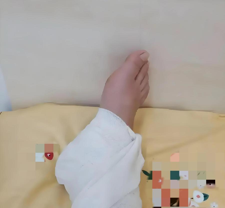 广西南宁，一起看似普通的摔伤事件，却让一名女职工从人社局一路打到最高法。女子上班