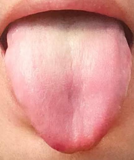 中年男士别焦虑！精力状态不佳无需忧心，中医气血同补，重拾内在底气






