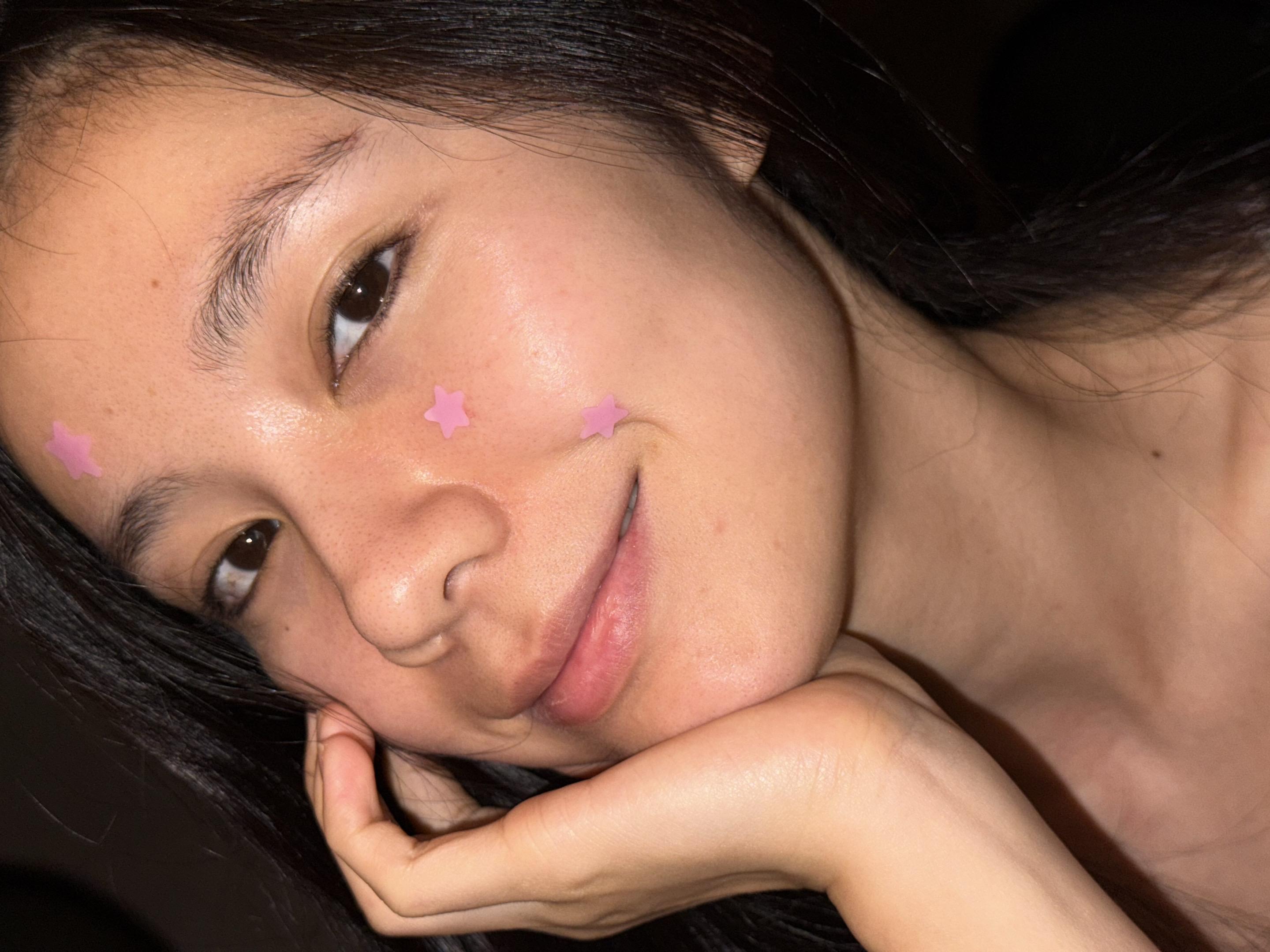 脸上长了星星💫 睡不着的时候的自拍