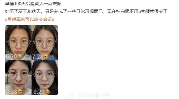 早睡真的可以改变命运 这个我还是相信的，起码早睡第二天脸不会黄...脸色不会这么