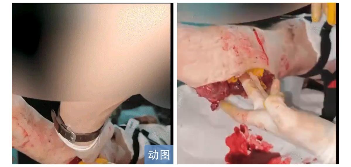 俄军军医测评白俄罗斯生产的新型止血剂（绷带）：

最近，我们收到了一种产自白俄罗