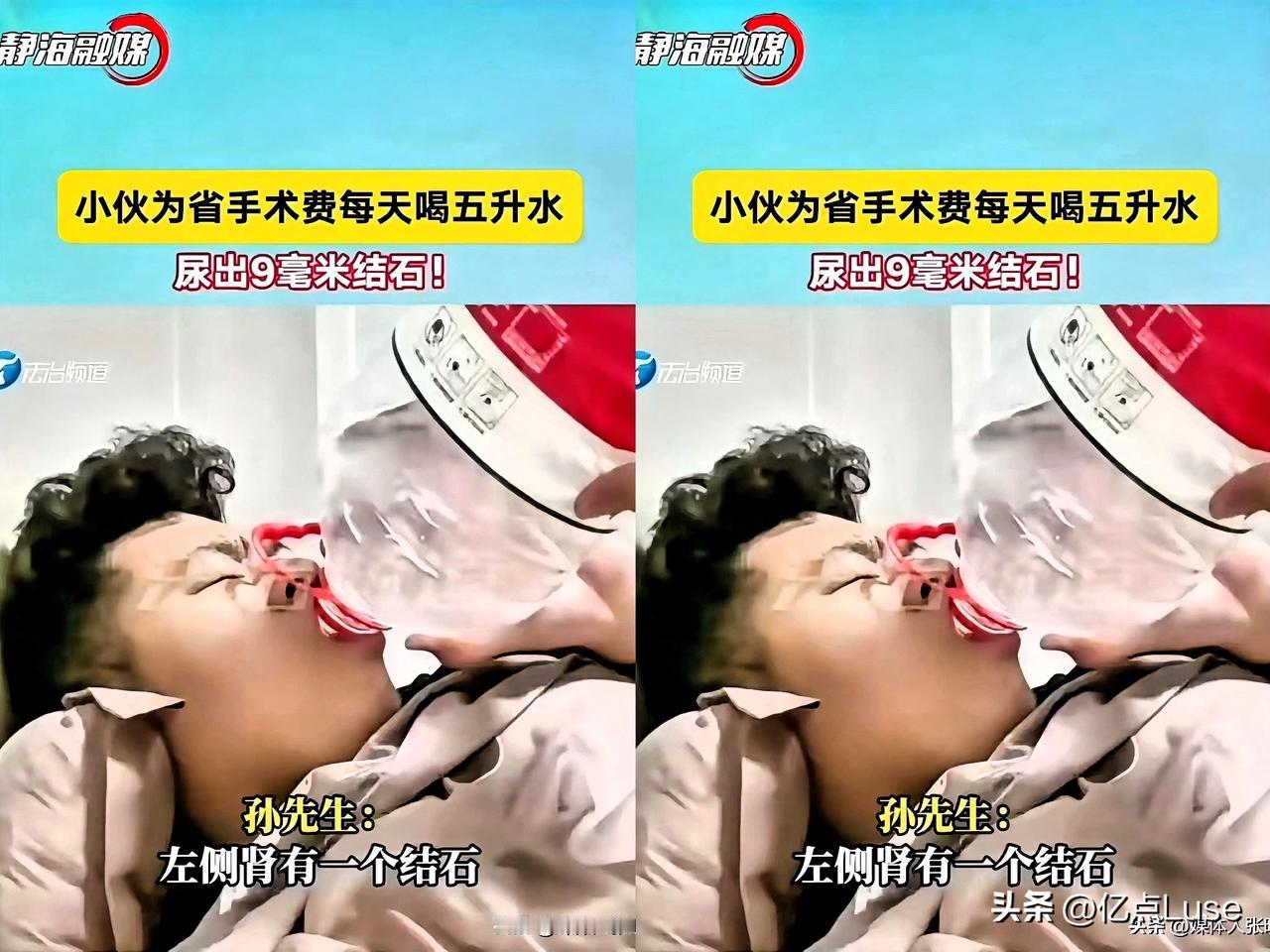 小伙堪称狠人！为省12000元手术费，每日喝五升水，竟尿出9毫米结石。小伙称：“