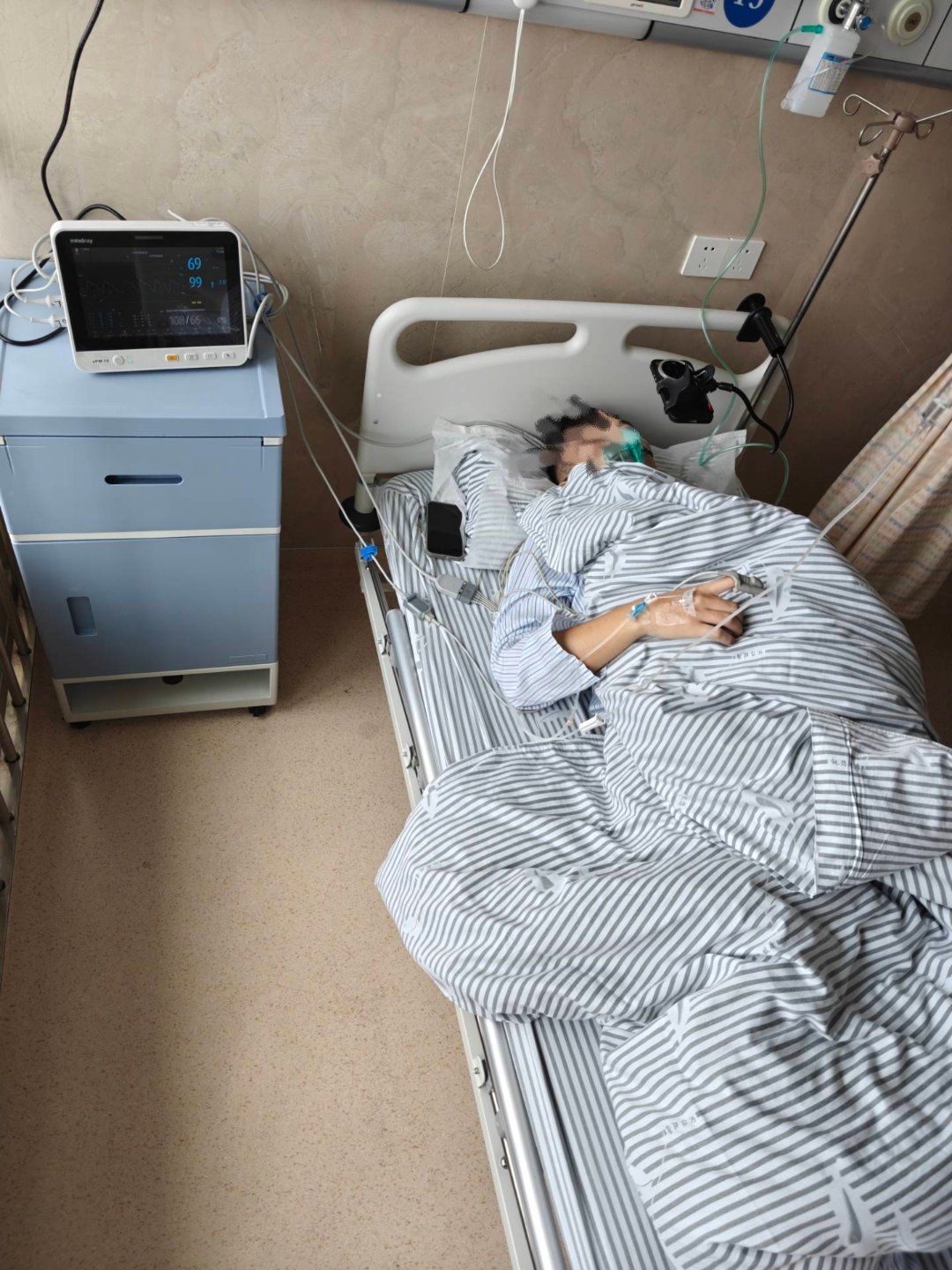 鼻子做手术不是很痛，全麻手术好处就在于过得快，会有一种眩晕感，然后醒来了就是手术