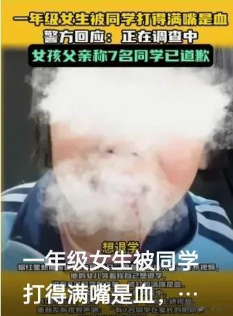 震惊全网！小女孩校园遭霸凌，满嘴鲜血哭喊退学！家长发视频求助，真相究竟如何？校园