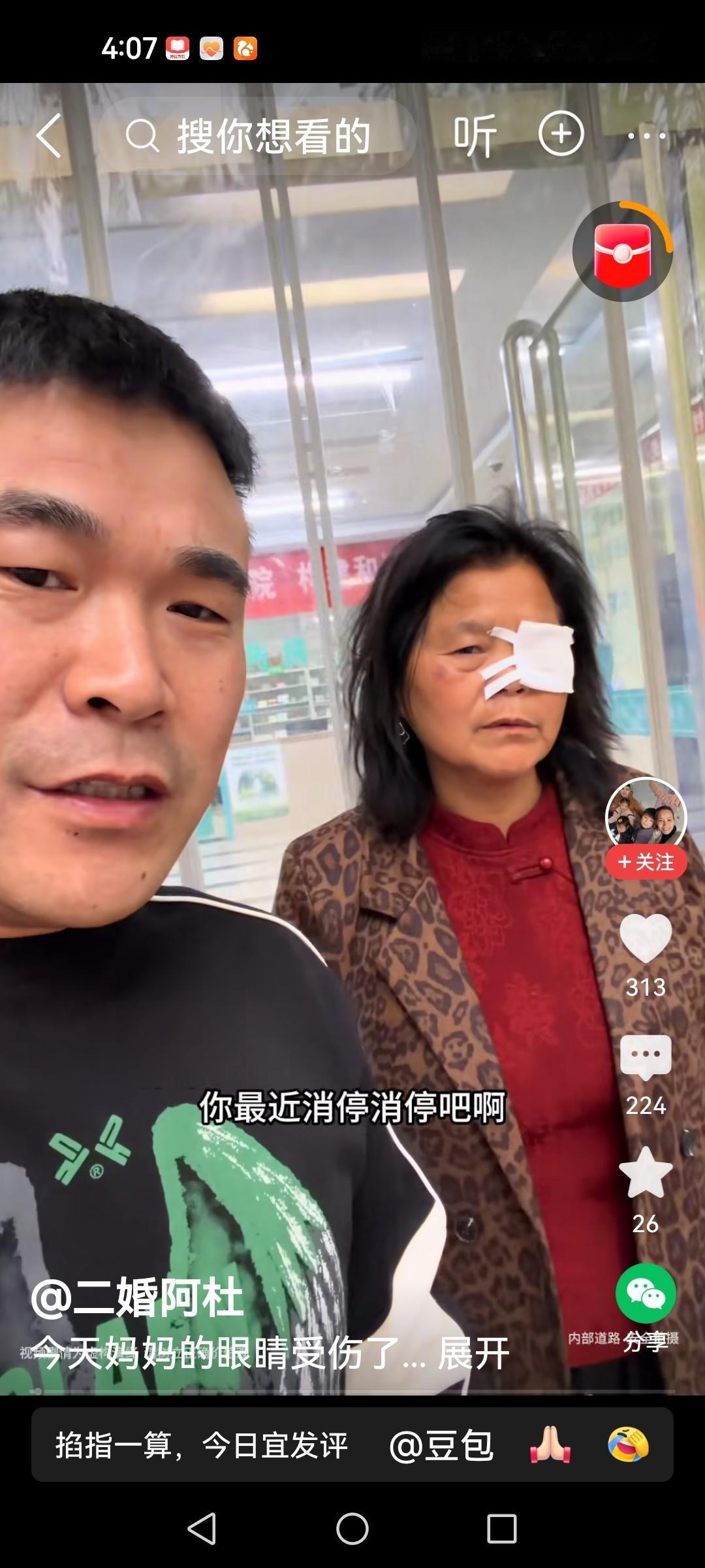 阿杜妈秒变“独眼龙”
李佳生活十分精彩像演戏
生活是一团麻，也有哪解不开的小疙瘩