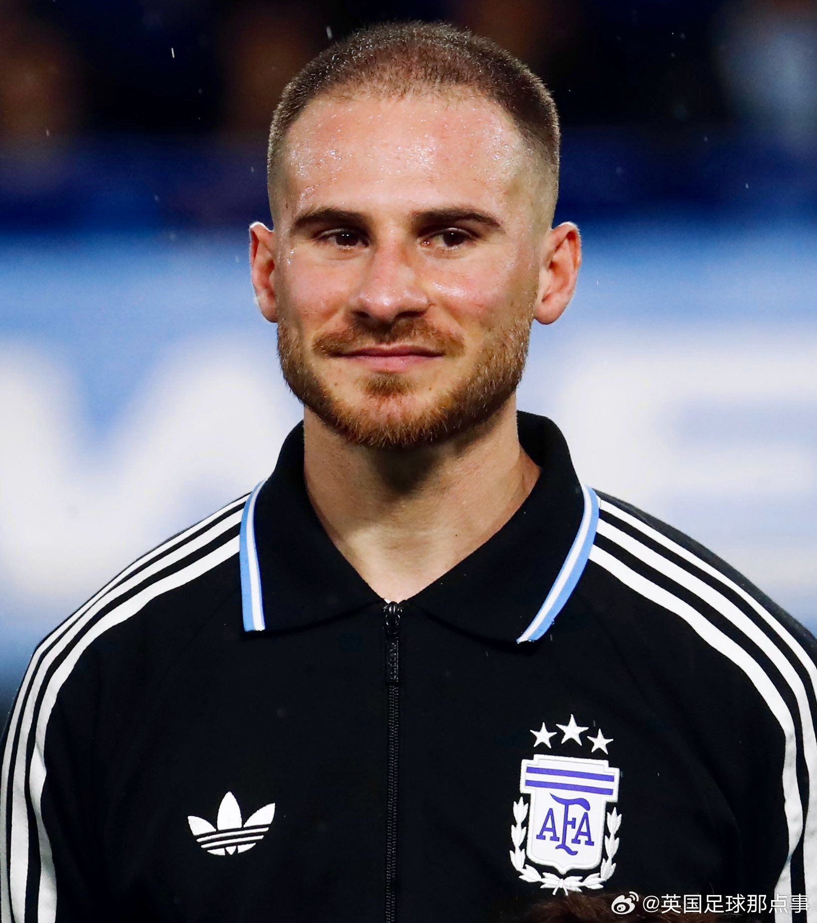 【从有头发的秃子变成真正的秃子😂】麦卡利斯特谈自己的全新发型：“我之前是个有头