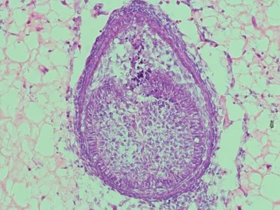 【🔬 科学突破：科学家正尝试培育人类牙齿，有望取代种植牙。】据CNN报道，全球