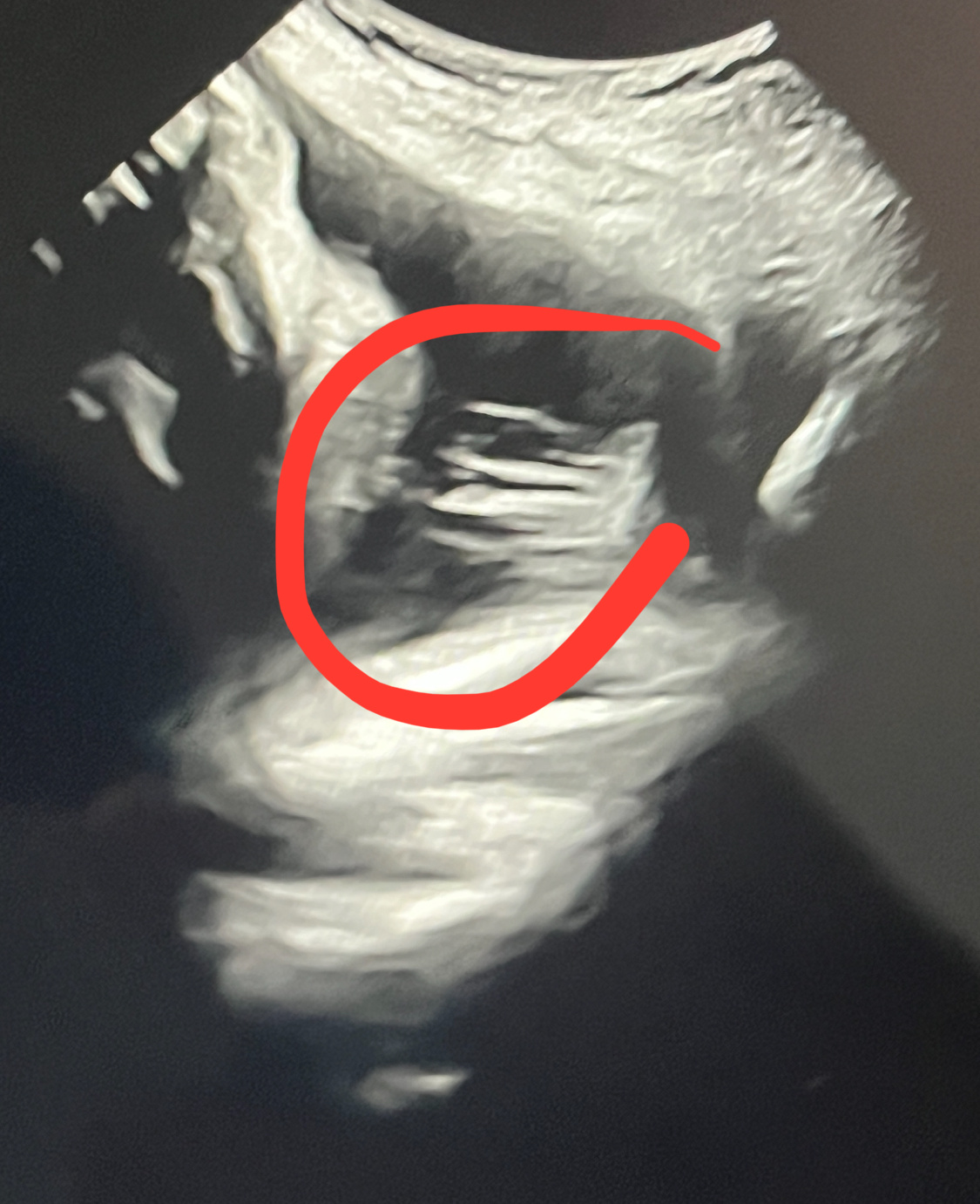 B超医生一声惊叹：“这发量，随爹！”我才知道原来这飘扬在羊水里的一缕一缕，是这家