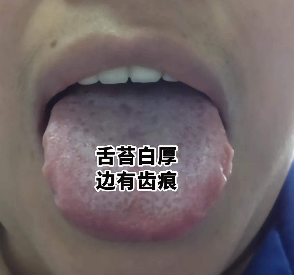 整天被老婆嫌弃，干啥啥不行[泣不成声]，真是已婚男人的宿命！病友诉苦：平时欲望很