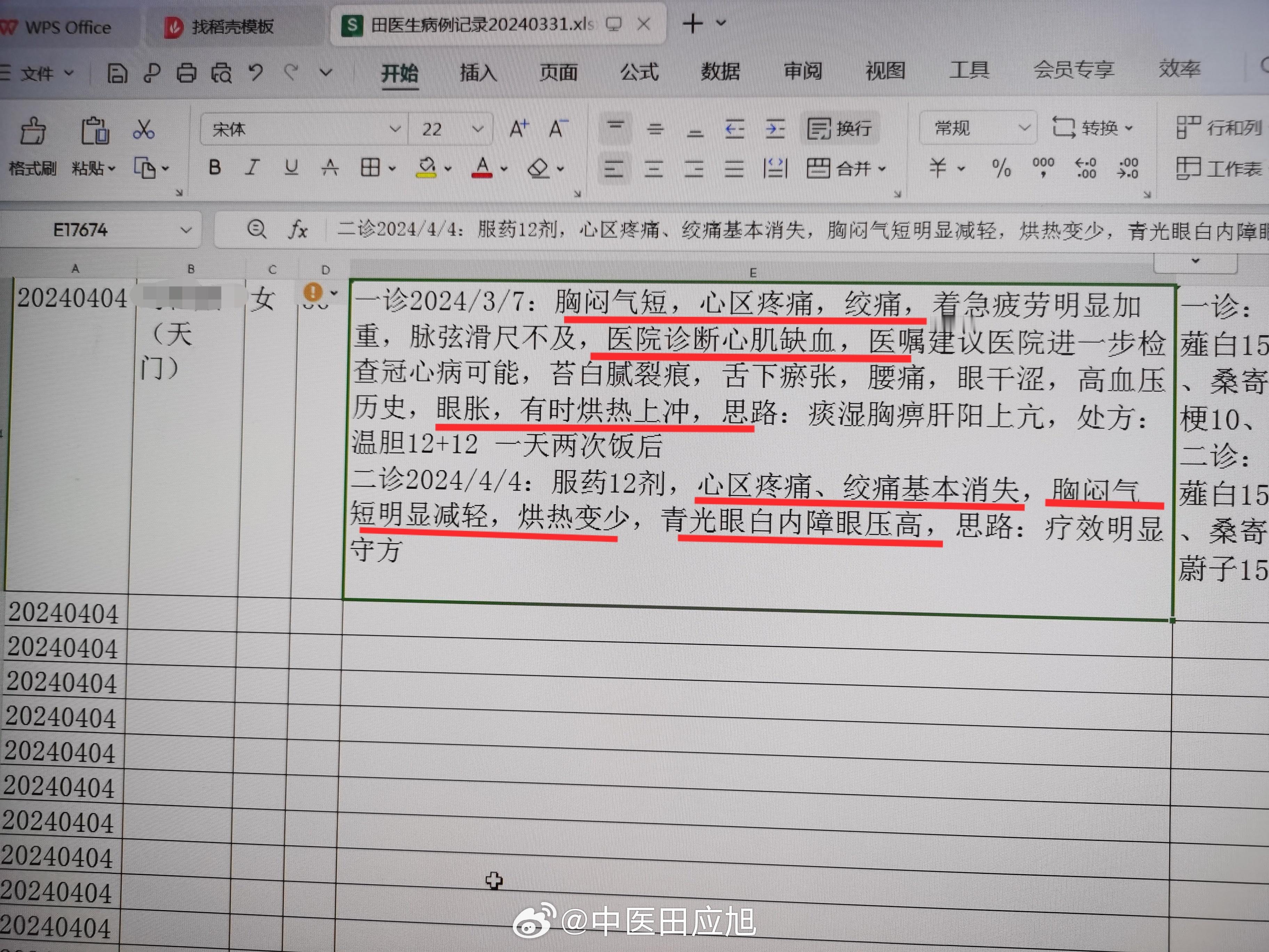 #中医##心肌缺血#  天门来的55岁大姐，胸闷气短，心区疼痛绞痛，疲劳着急加重