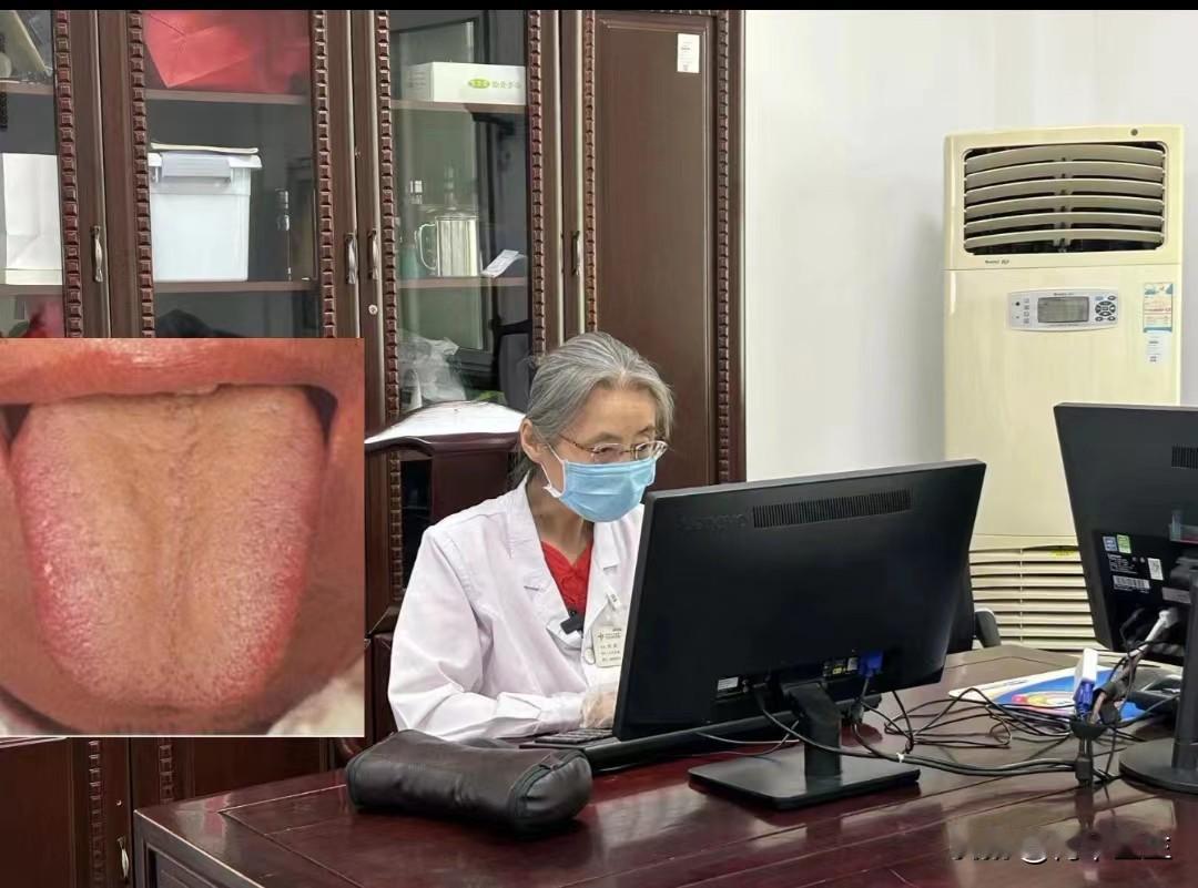 【舌象分析】像这种舌象啊，不管你是吃逍遥丸，还是吃柴胡舒肝丸，说实话根本没有什么