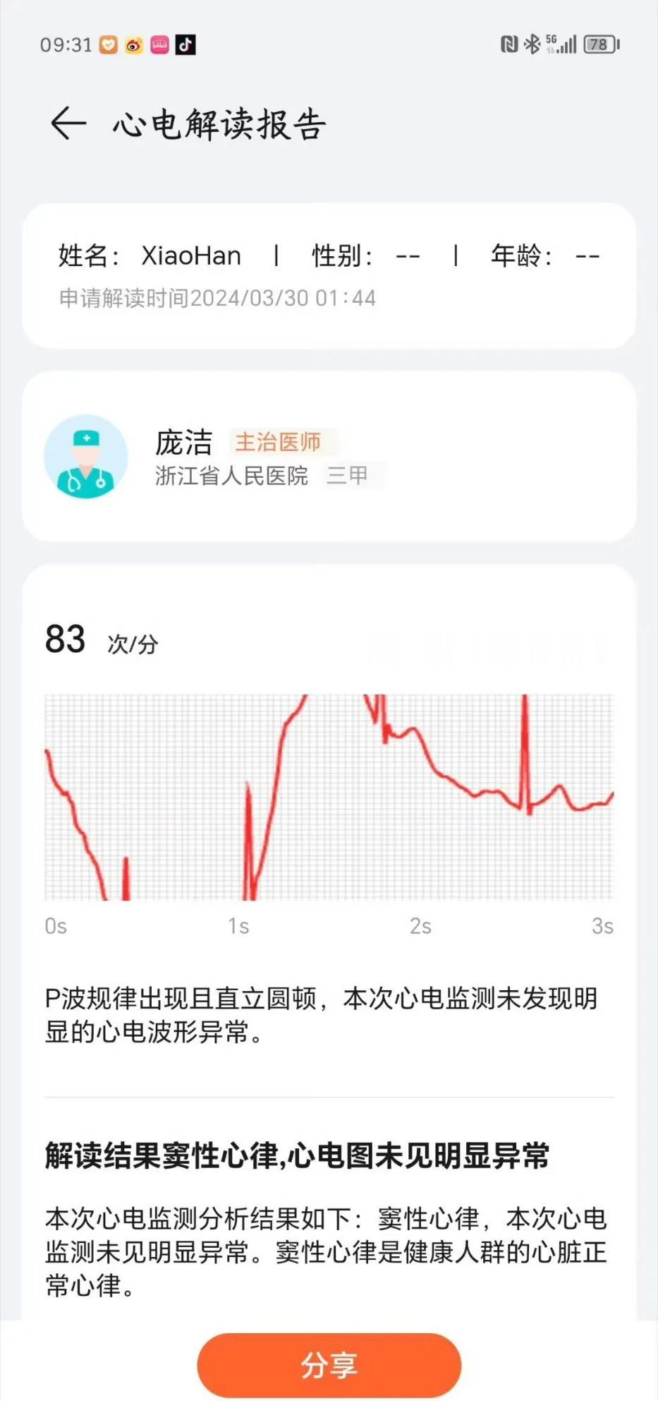 荣耀手表4 Pro的心电图功能确实非常实用！

它能提供三甲医院医生的解读，让你