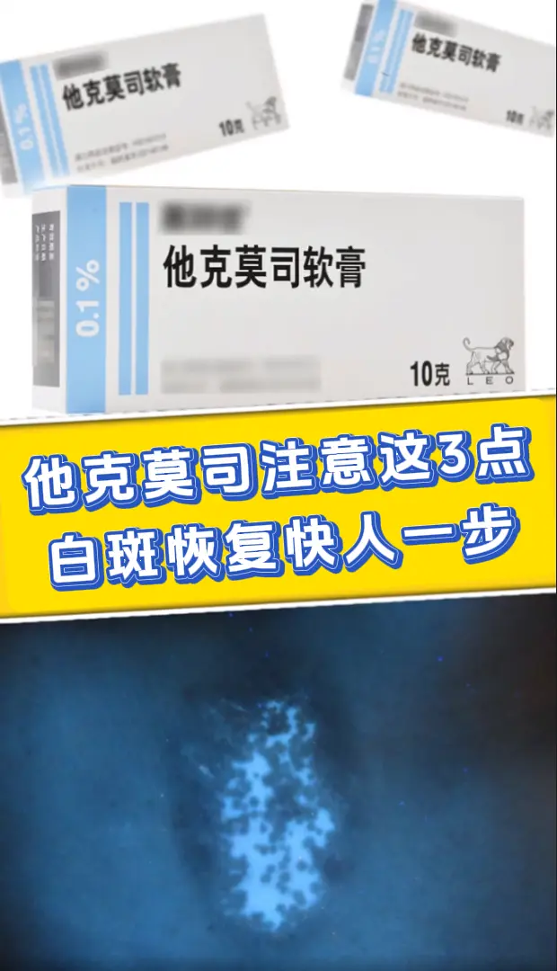 他克莫司在使用时有以下几点需注意： 1、注意选对浓度。他克莫司有0.0...