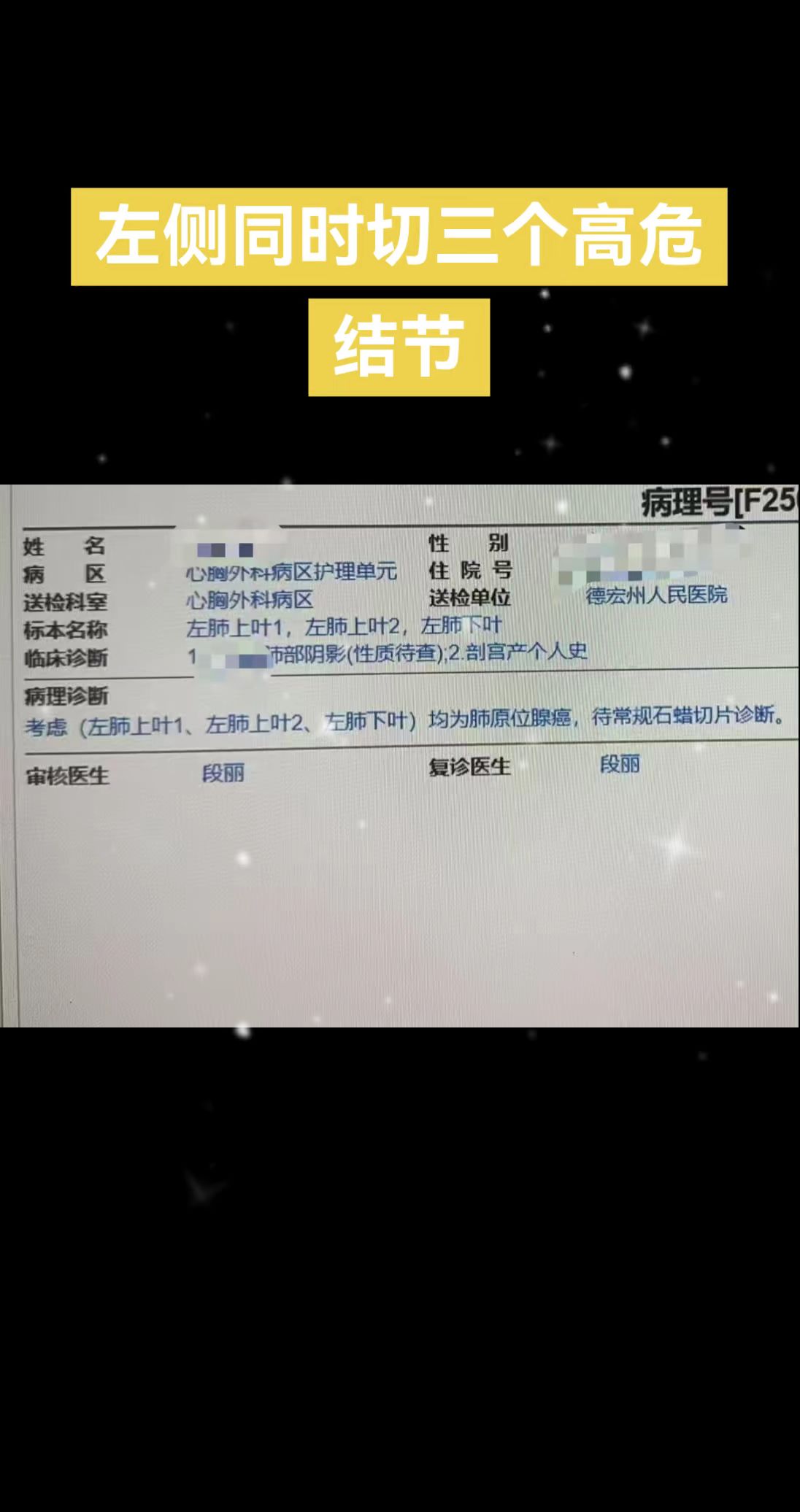 左侧同时切三个高危结节。左侧同时切三个高危结节，避免未来再做同侧手术……