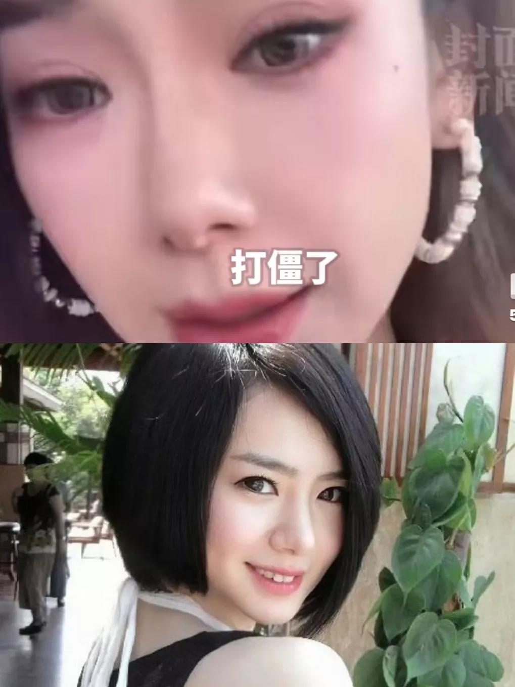 戚薇有钱，我不羡慕
戚薇老公愿意主内，我也不羡慕
可看见戚薇说她打肉毒打僵了
这