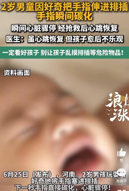 河南一个2岁的小男孩，趁大人没注意，把手指头塞进了排插的插孔里。就那么一瞬间，手
