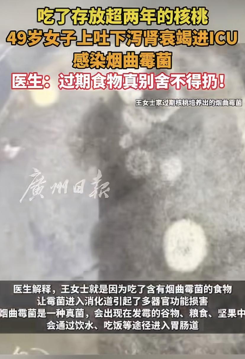 浙江丽水49岁的王女士怎么也没想到，几颗存了两年多的核桃，配上隔夜剩饭，竟把自己