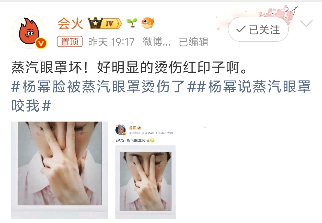 杨幂脸被蒸汽眼罩烫伤了好家伙， 反正我看好多科普都说，一定不要超长时间戴，要不真