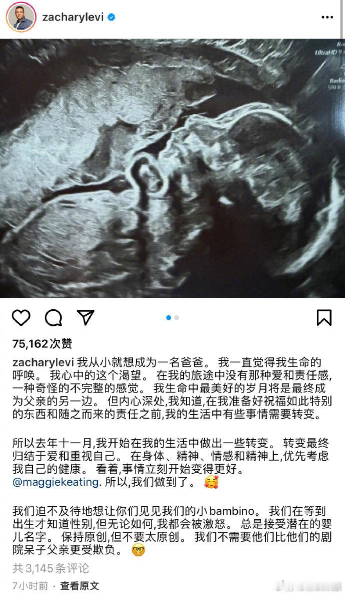 沙赞当爸  沙赞女友怀孕  44岁的Zachary Levi宣布将与女友Magg