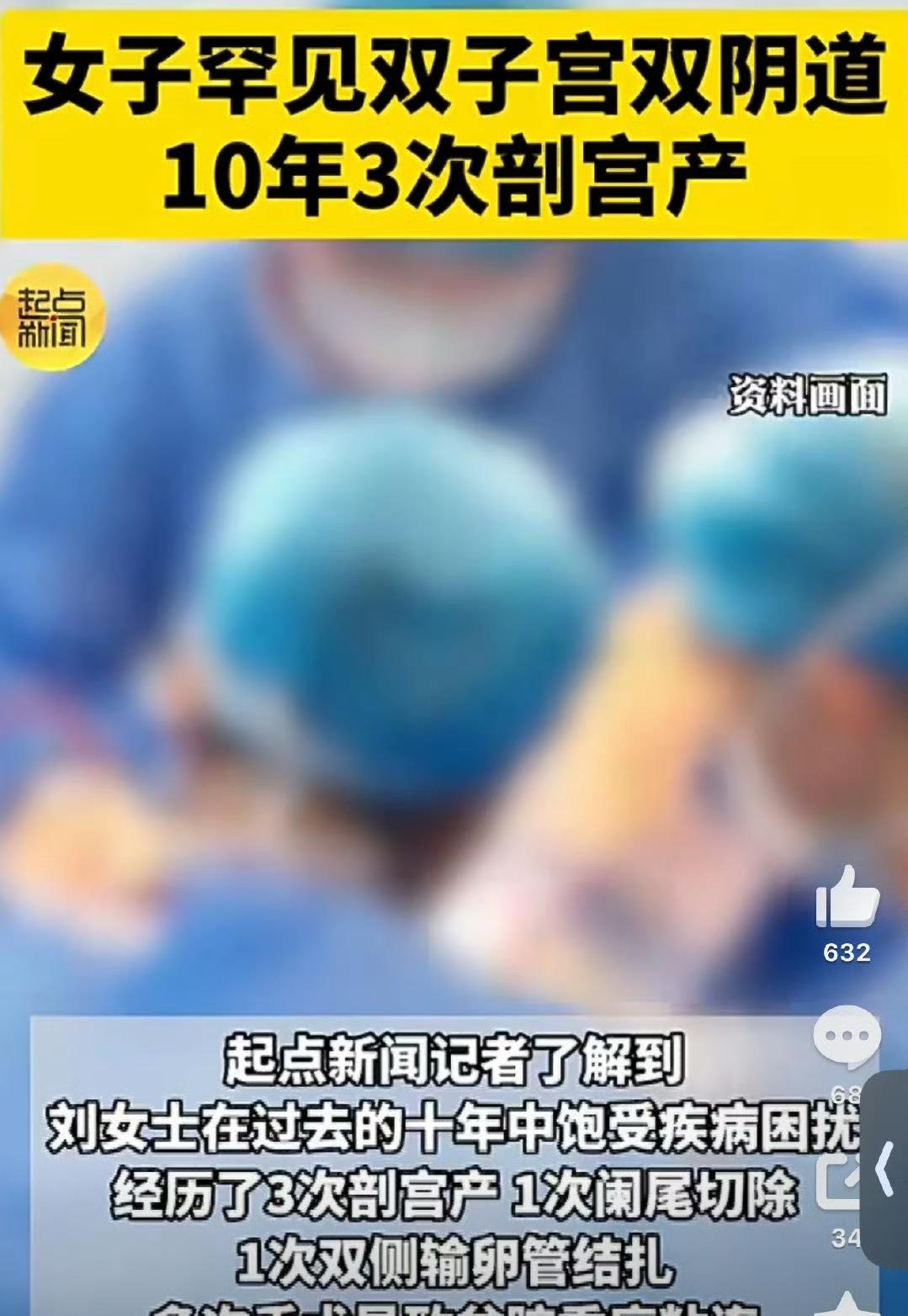 陕西西安45岁刘女士罕见双子宫双阴道，10年3次剖宫产的事儿引发热议。双子宫双阴