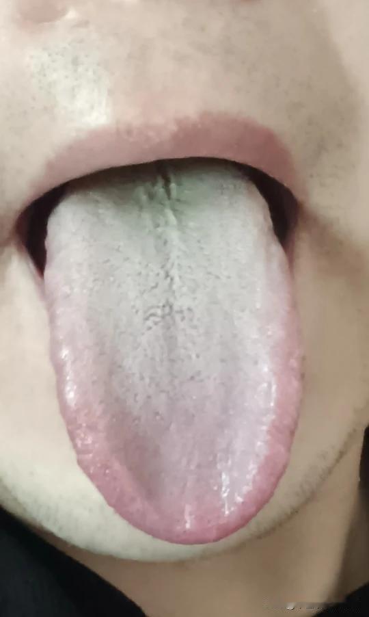 门诊30来岁大哥，我是真无语，有病看病，你拖着干嘛[what]
很多问题都是，你