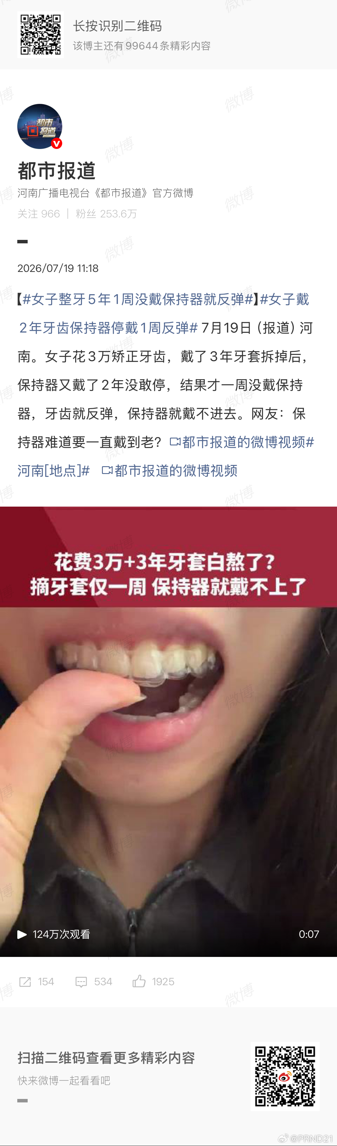 女子戴2年牙齿保持器停戴1周反弹 那要看之前计划如何了，有些年龄较大的正畸患者是