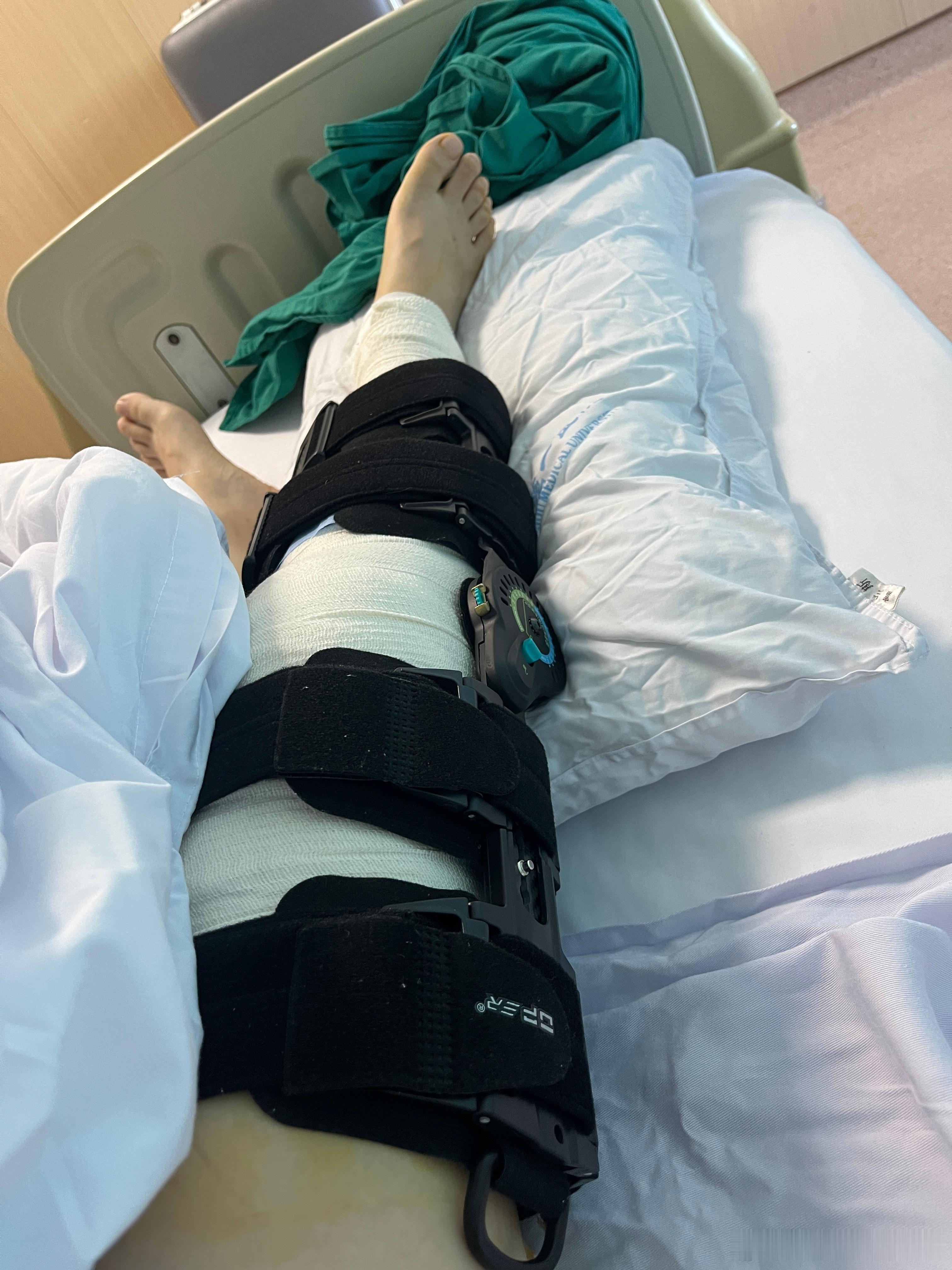 先是静脉给了止痛药，人就已经开始晕乎了。然后右大腿和小腿又分别打了麻醉。再然后就