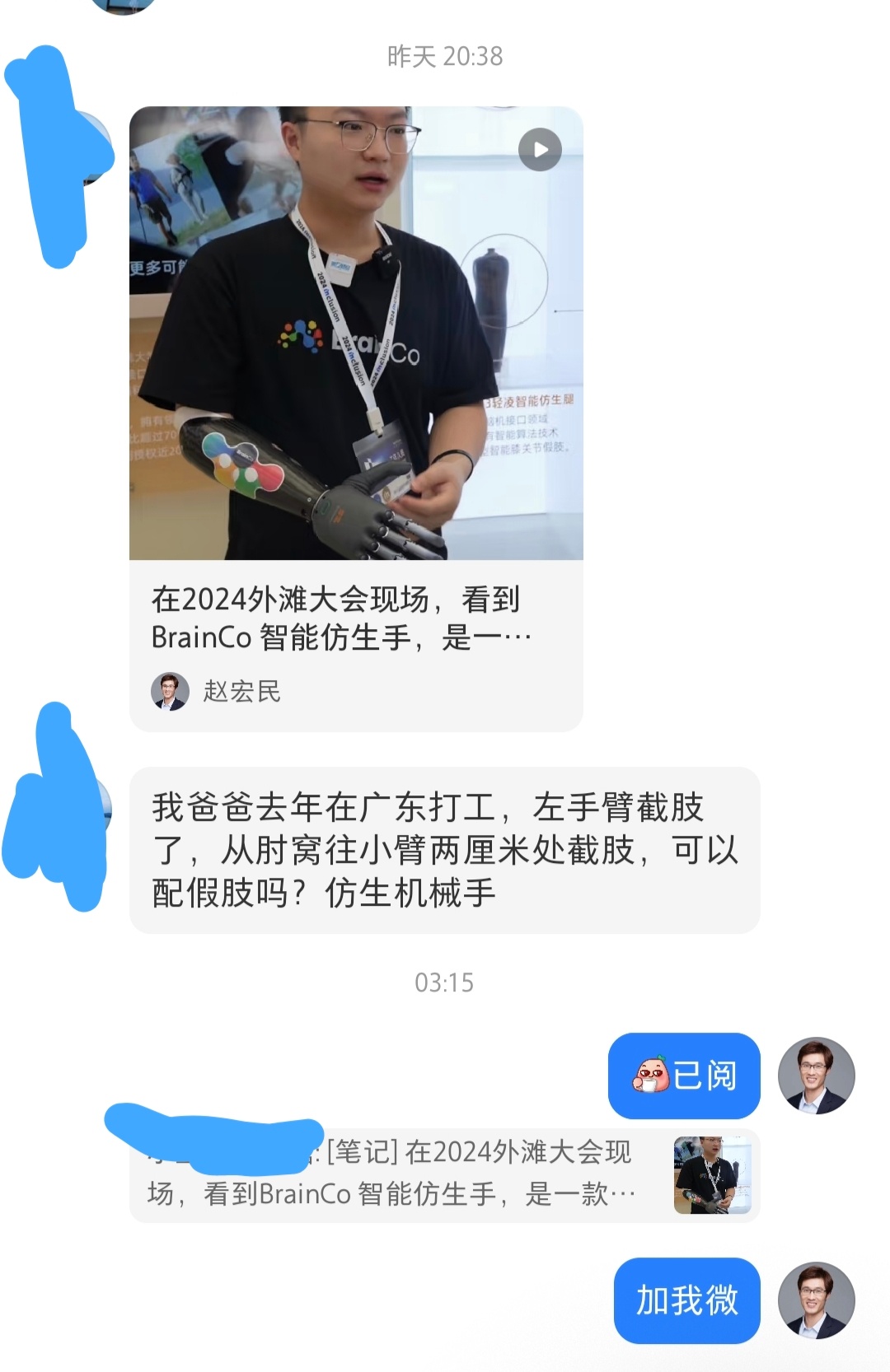 一位孝顺的网友问我 :她爸爸去年在广东打工，左手臂截肢了，从肘窝往小臂两厘米处截