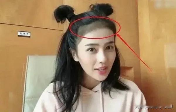 这个发际线是啥啊 有点搞笑