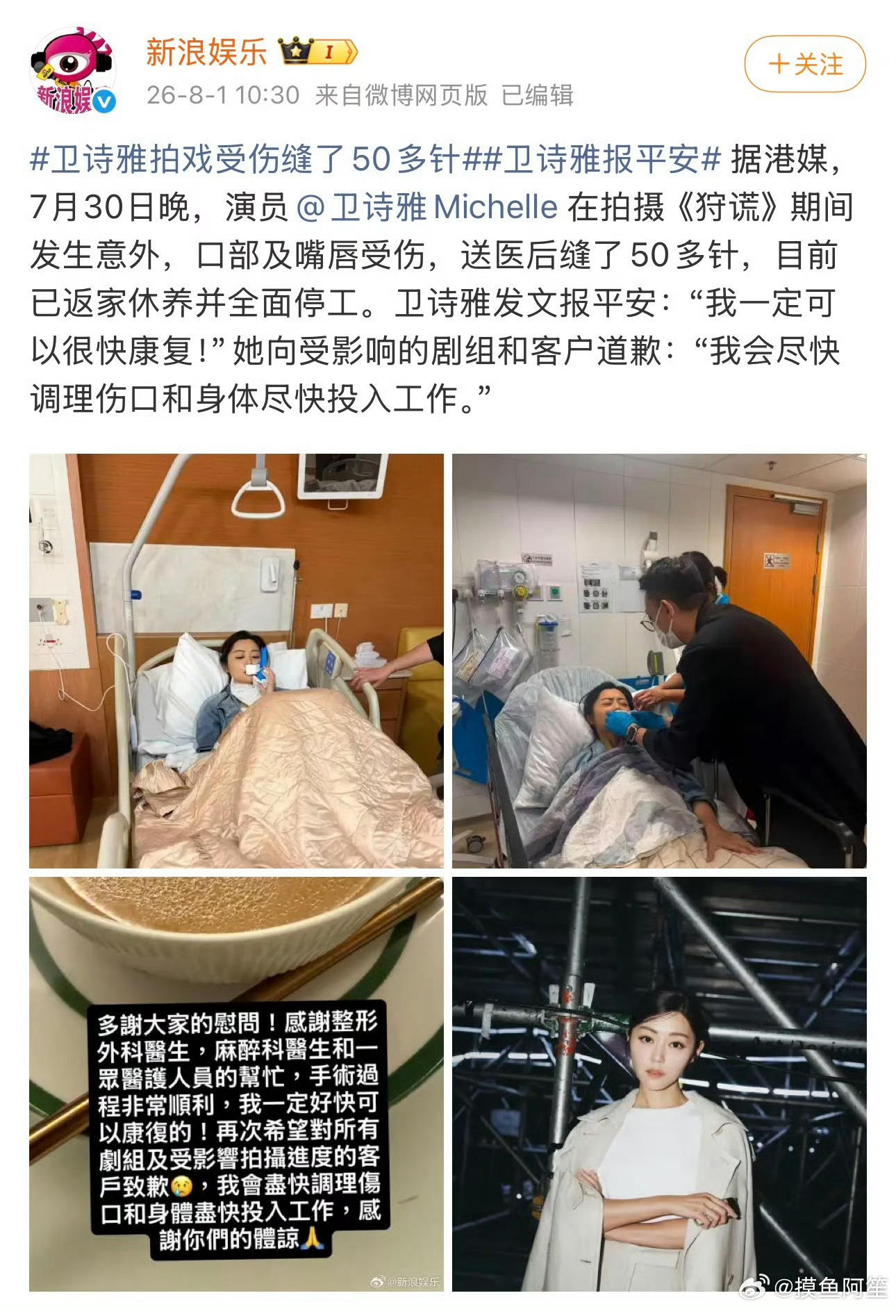 怎么最近几年总是有女演员受伤事故，伤的还是脸……这剧组又是咋回事 