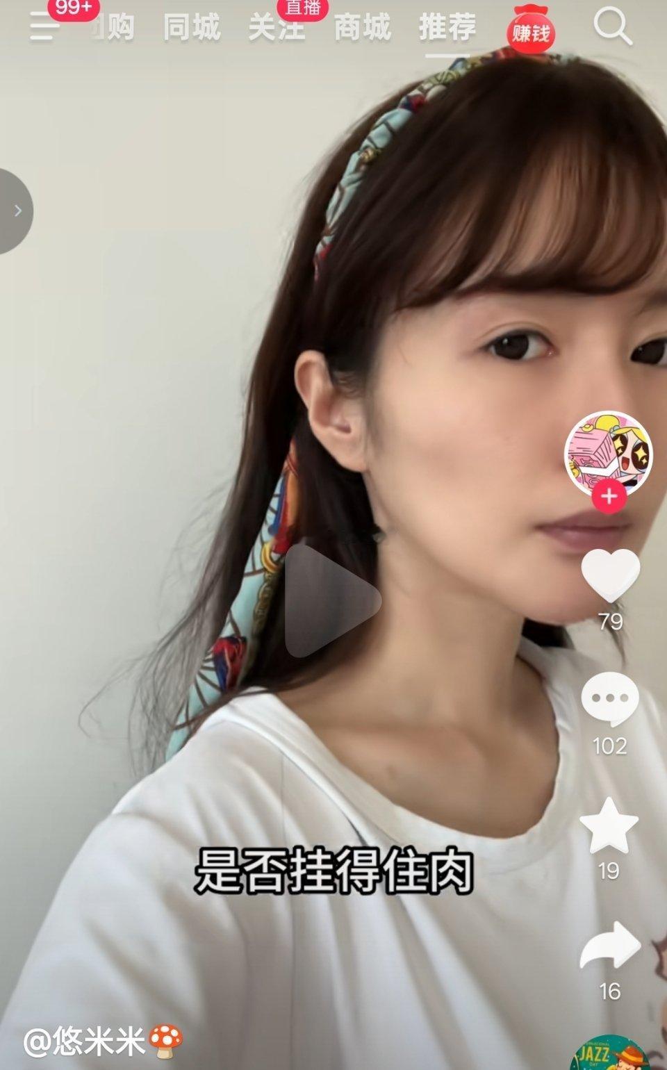 我完全不认可图1、图2、图3里的说法。她说“下颌能不能挂得住肉，不取决于有没有下