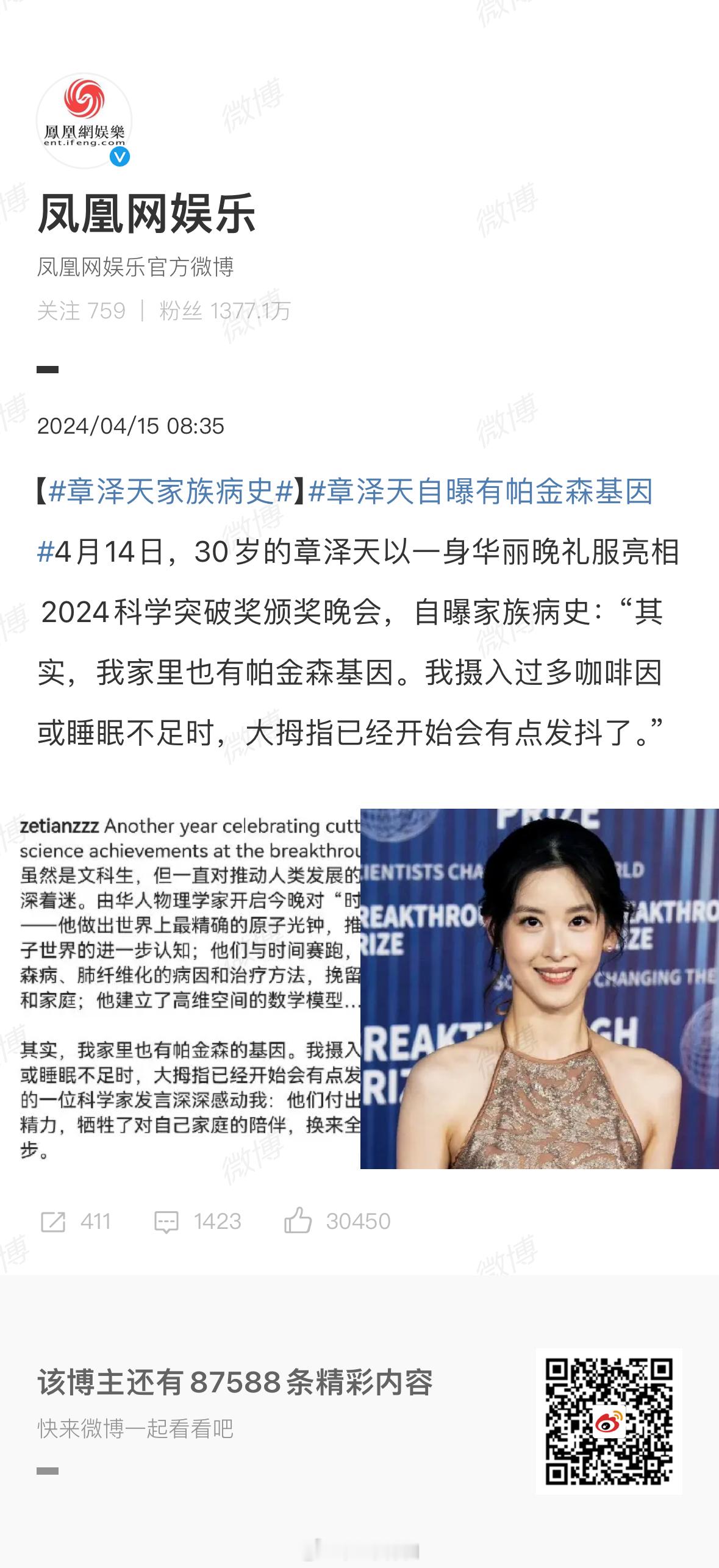 #章泽天家族病史##章泽天自曝有帕金森基因# 感谢章泽天女士对于科研和慈善事业的