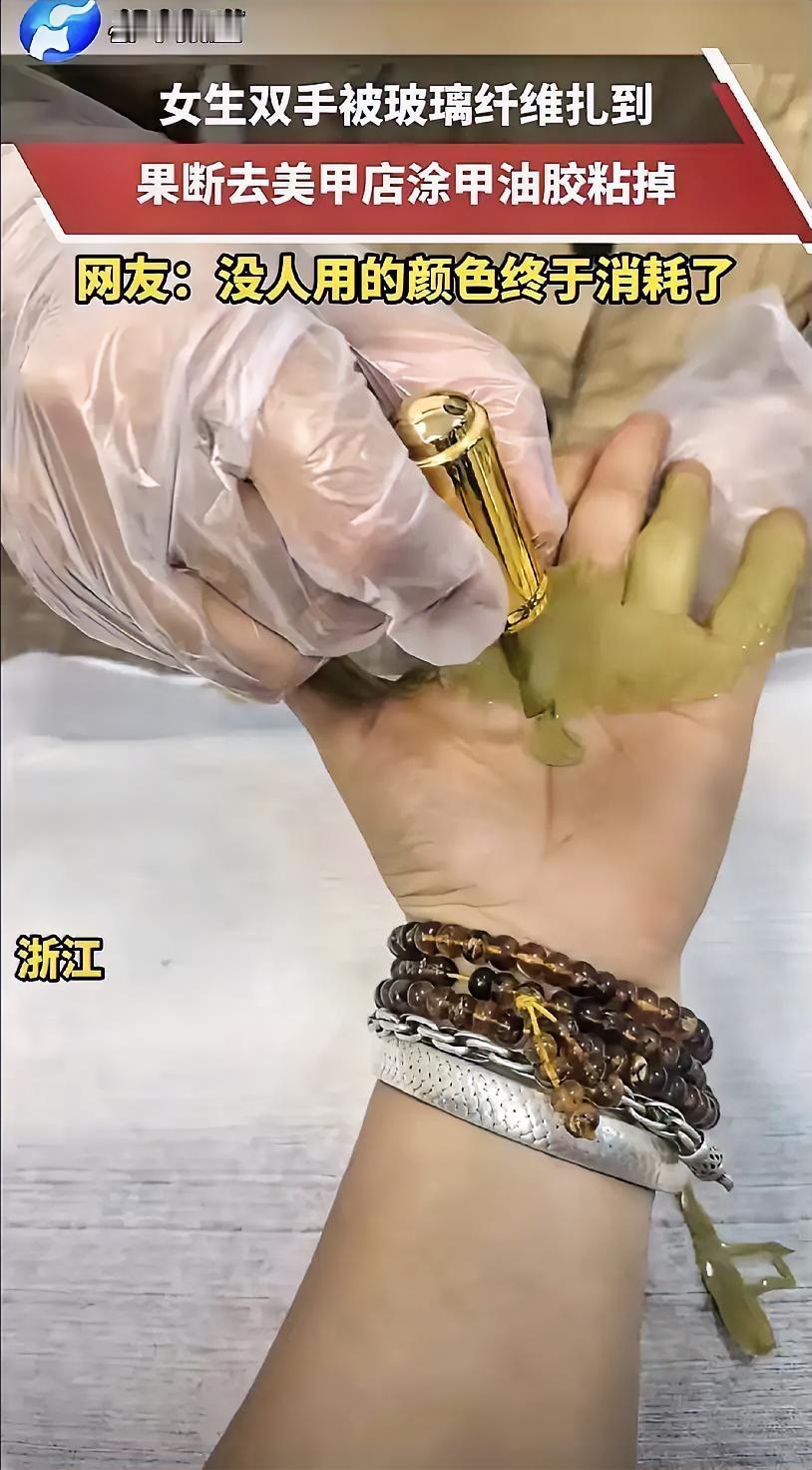 人怎么能这么聪明！浙江，一女子手被玻璃纤维扎到，可她既没有自己拔，也没有去医院，