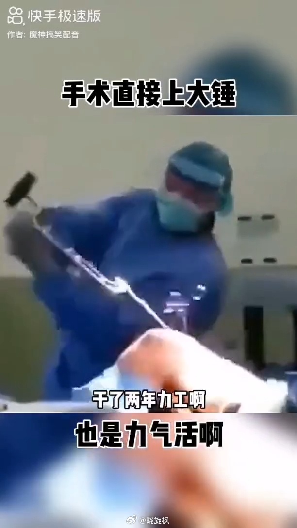 【#医学的尽头是钳工#】蜥蜴把十八层地狱的刑法拿来人间了！中医手法正骨不开刀就能