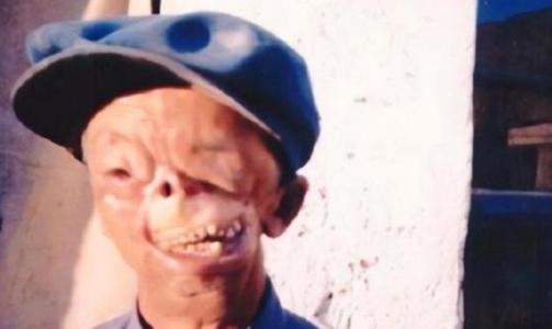 1950年，3岁的他被狼咬掉了半张脸后，被父亲无情的扔到山洞中，没哟想到他却顽强