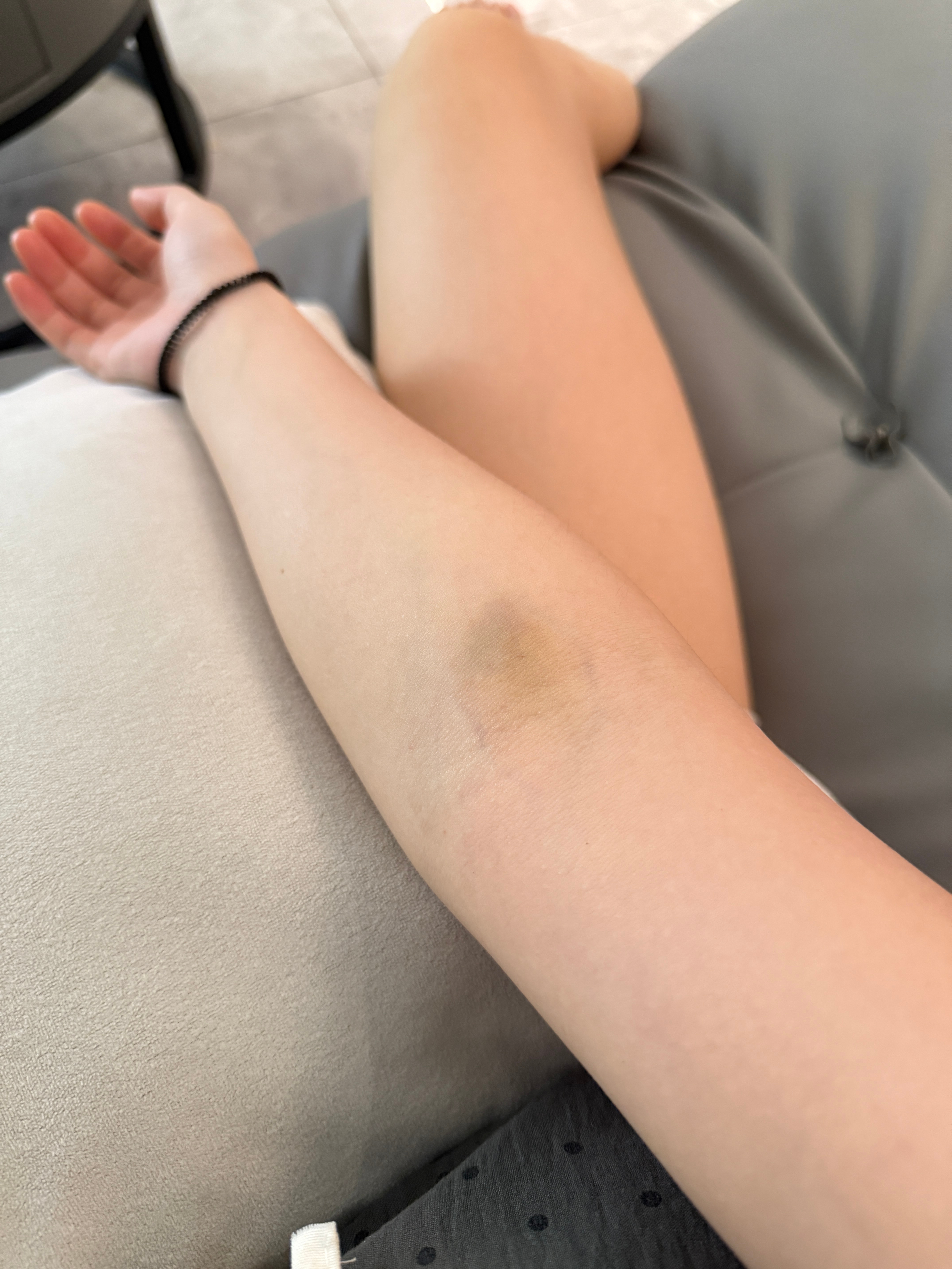 被麻醉之后说出来的话和行为是完全大脑无序无意识的还是一种心理压抑的发泄呢？护士和