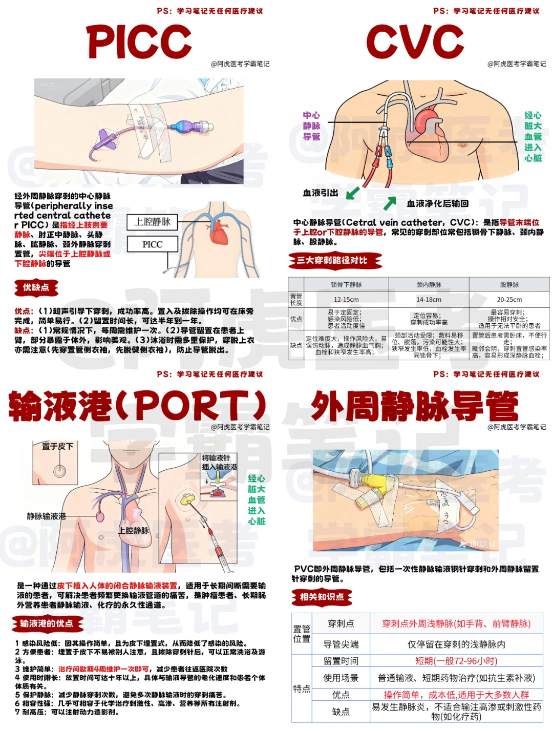 PVC、CVC、PICC、PORT有什么区别❓速来码住