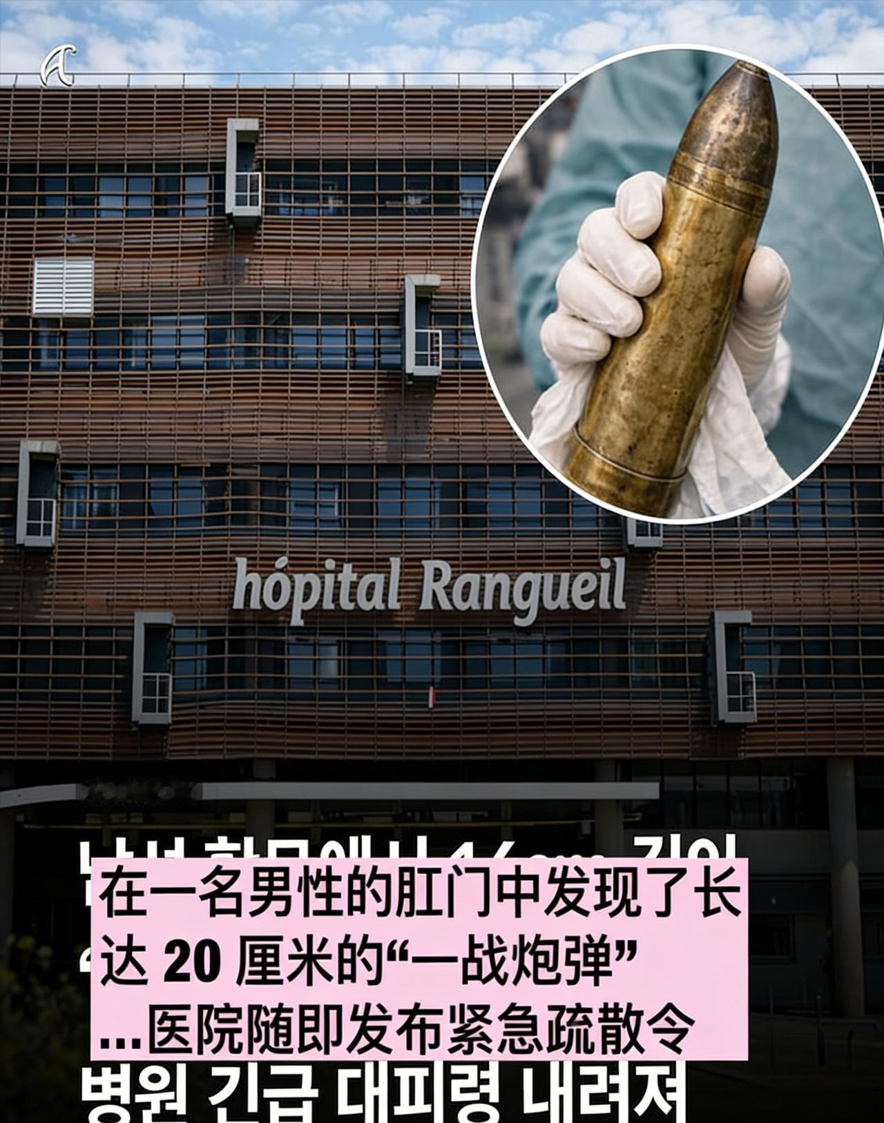 法国男子硬核整活！往自己皮燕子塞了一枚炮弹

1月31日深夜图卢兹一家医院，24