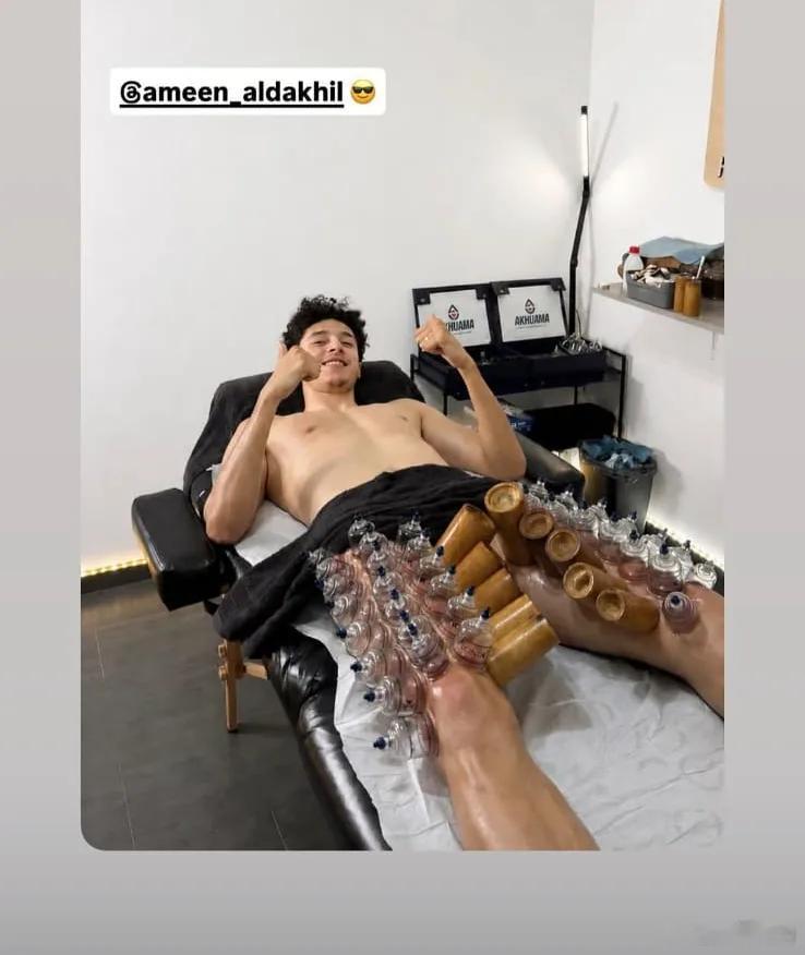 见过拔火罐的，没见过那么多瓶瓶罐罐的……认识一下，斯图加特后卫达希勒 