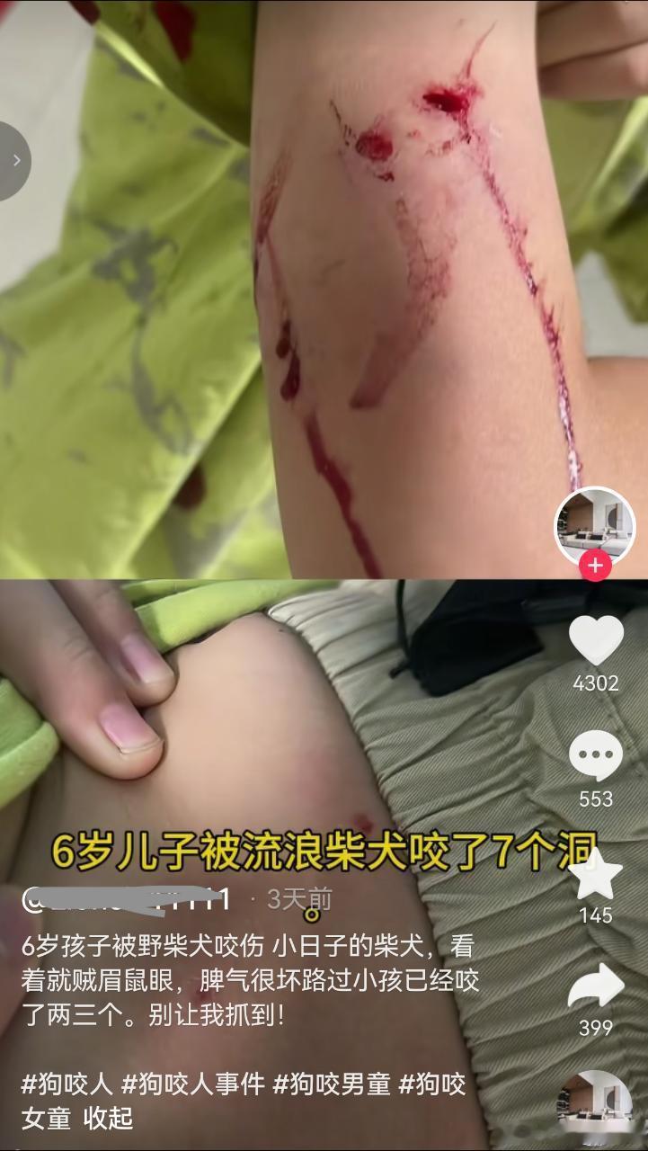现在人的胆子也太大了吧，竟然敢放话去清理流浪犬。就不怕明星艺人说残忍吗？就不怕媒