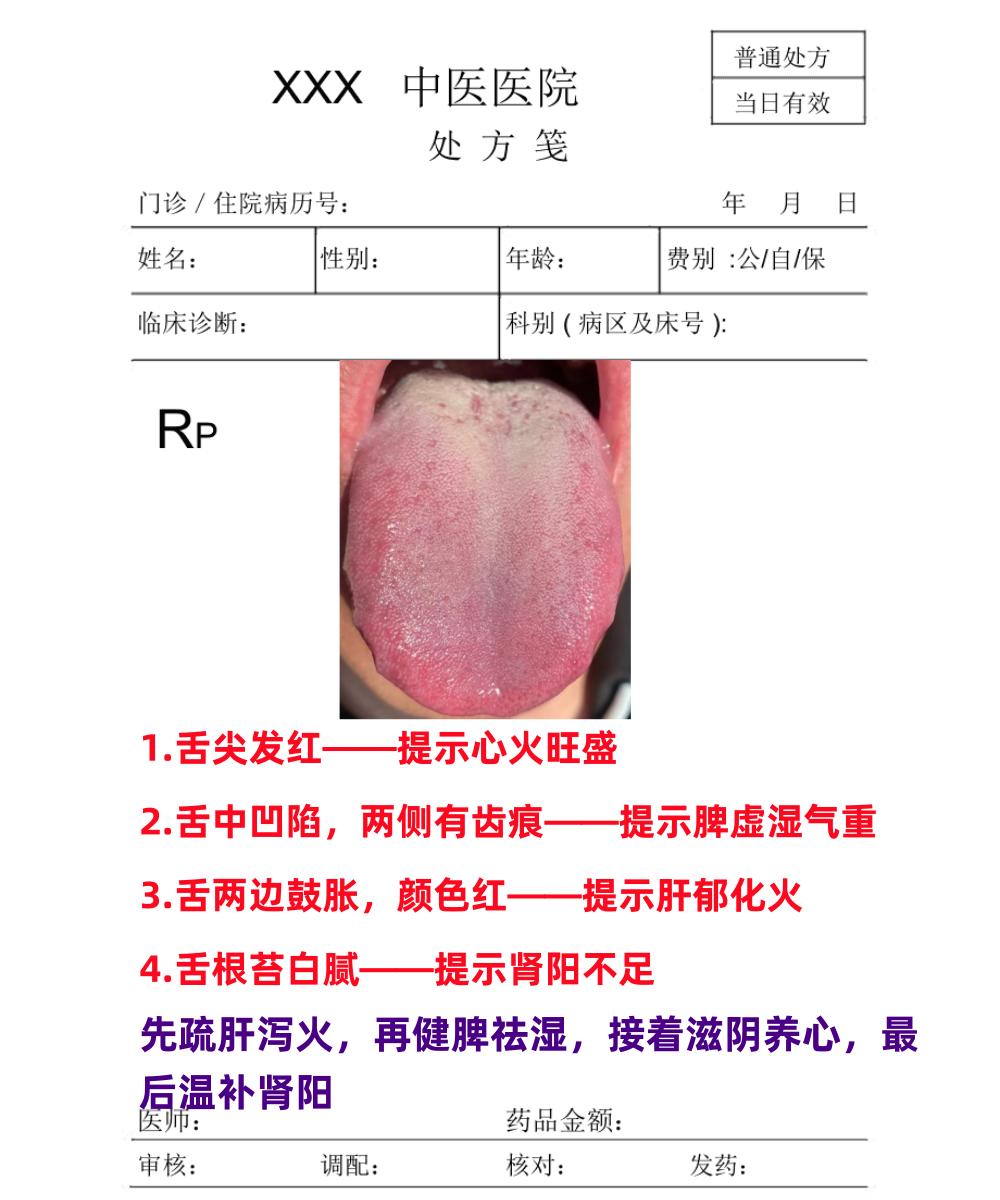 中医舌诊挑战第5天！！！

今天继续坚持来看舌象，大家想要了解身体健康的，只要你